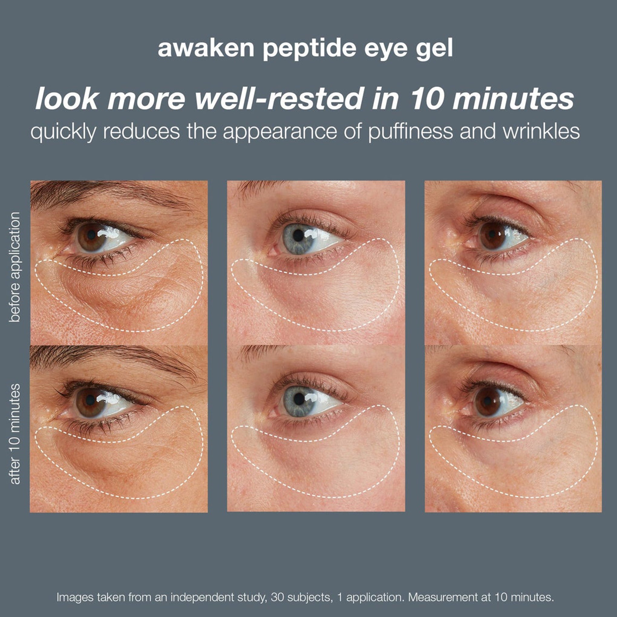 awaken peptide depuffing eye gel