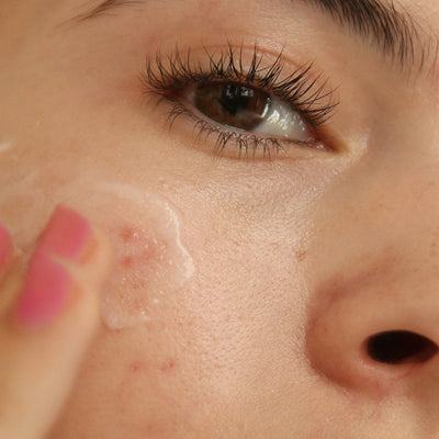 what are acne-causing ingredients?