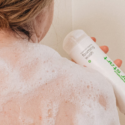 what is the difference between pimples and acne?
