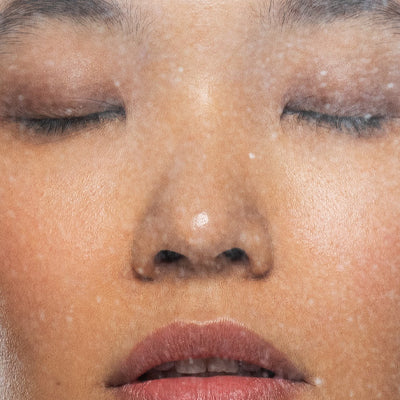 what is the skin barrier – and why does it matter?