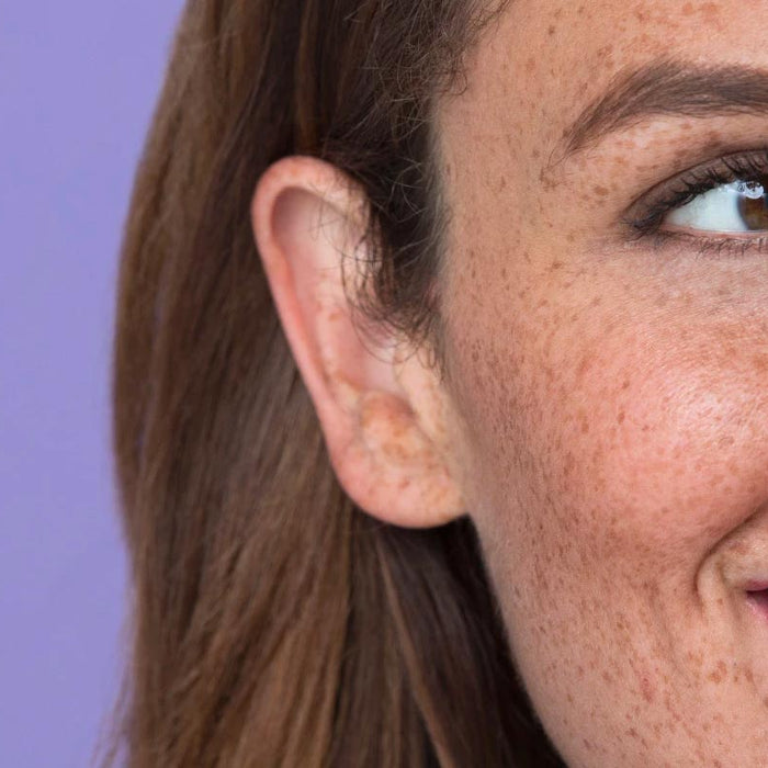 could your sensitive skin be caused by your environment?