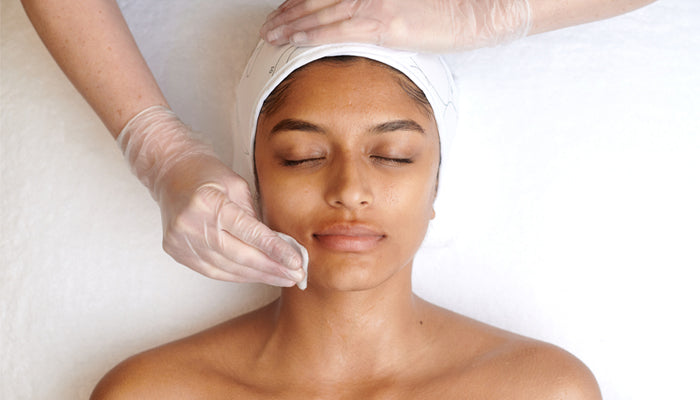 how to care for your skin after a peel
