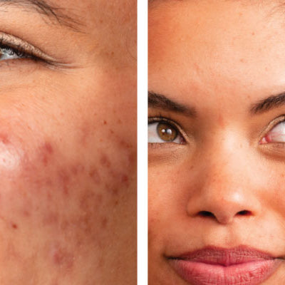 Why is my skin changing?