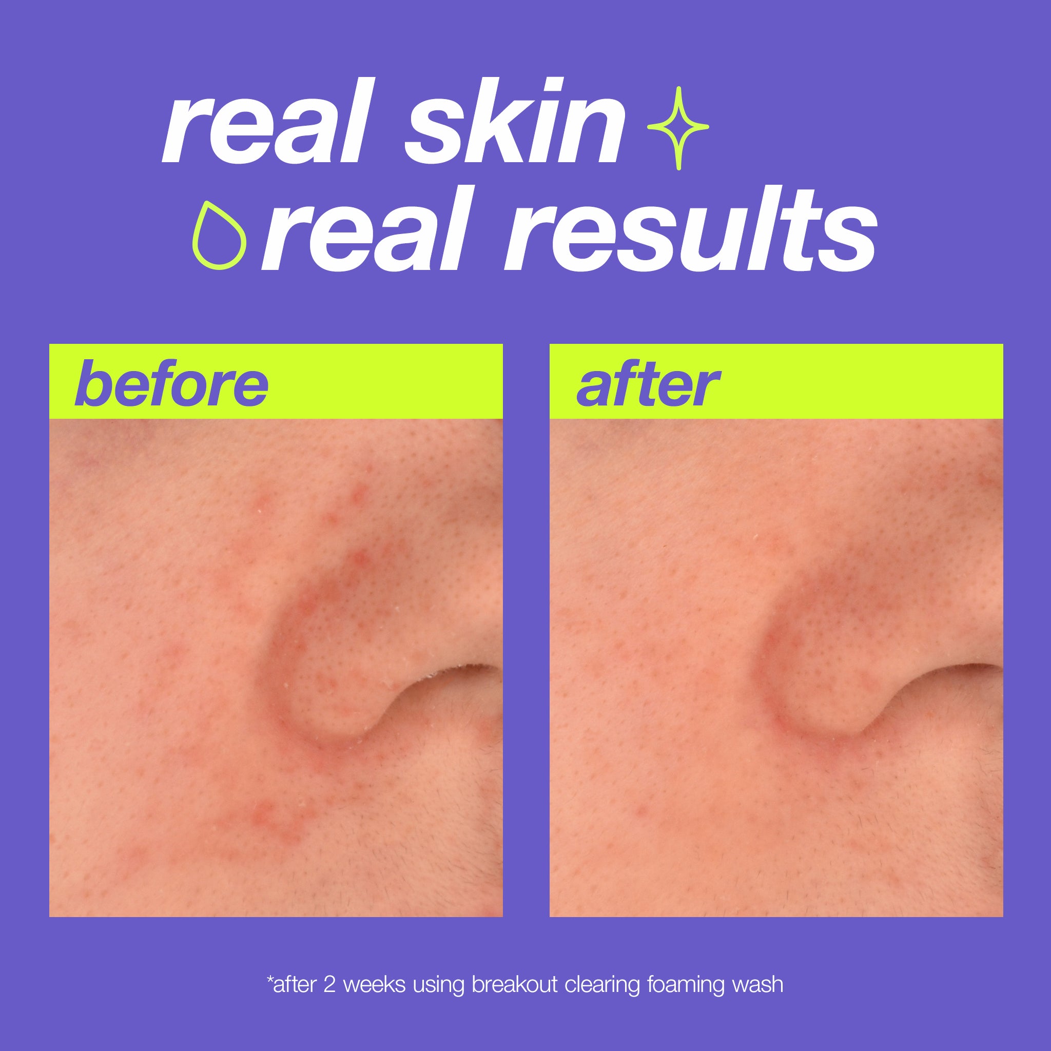 breakout clearing foaming wash