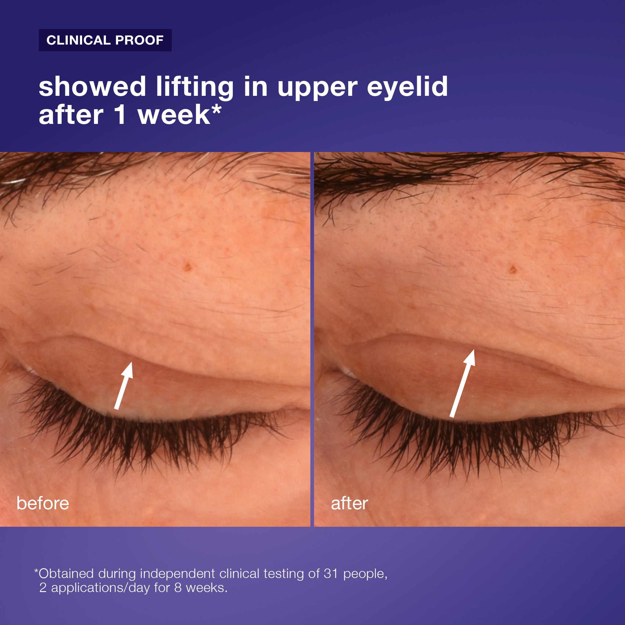 phyto nature lifting eye cream