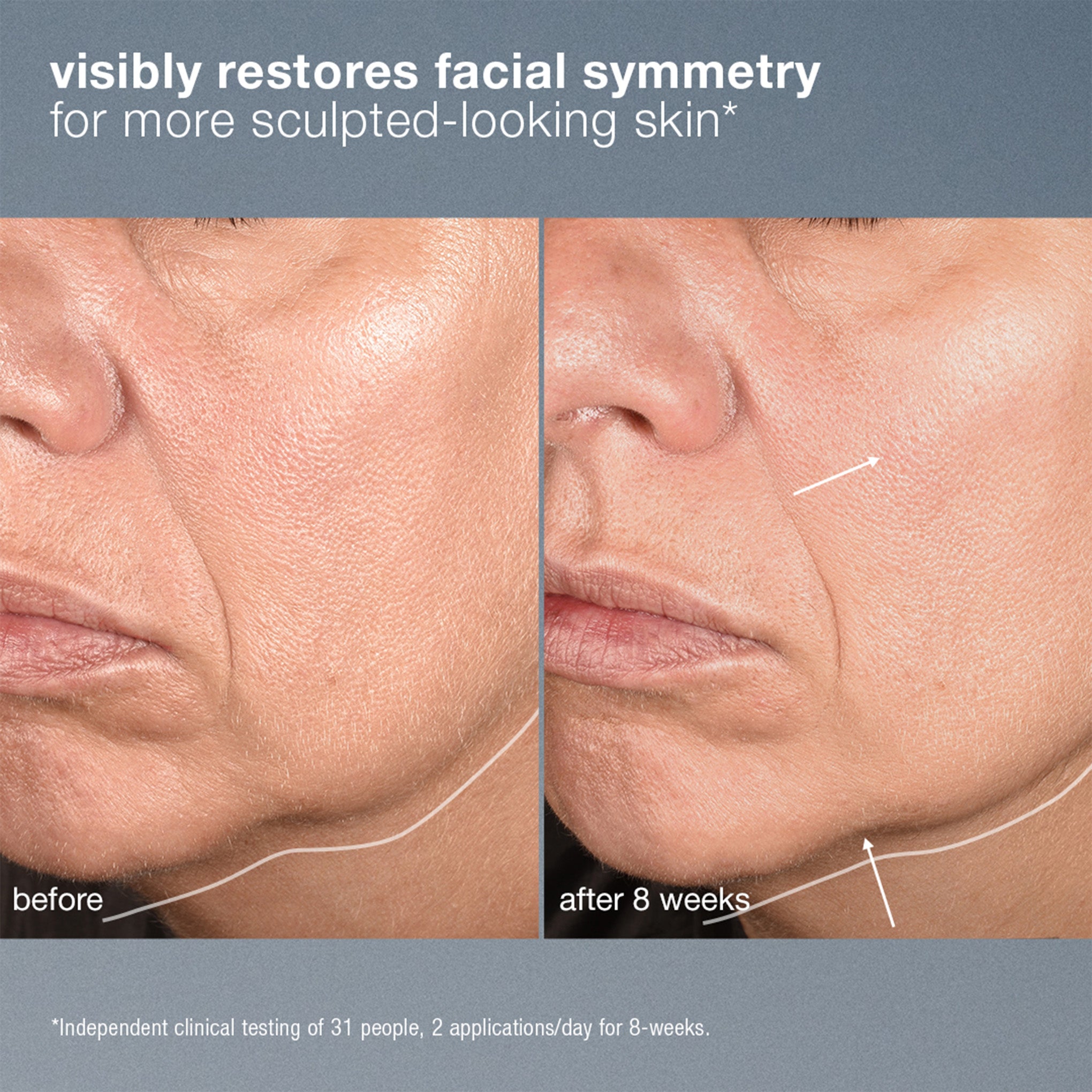 neurotouch symmetry serum