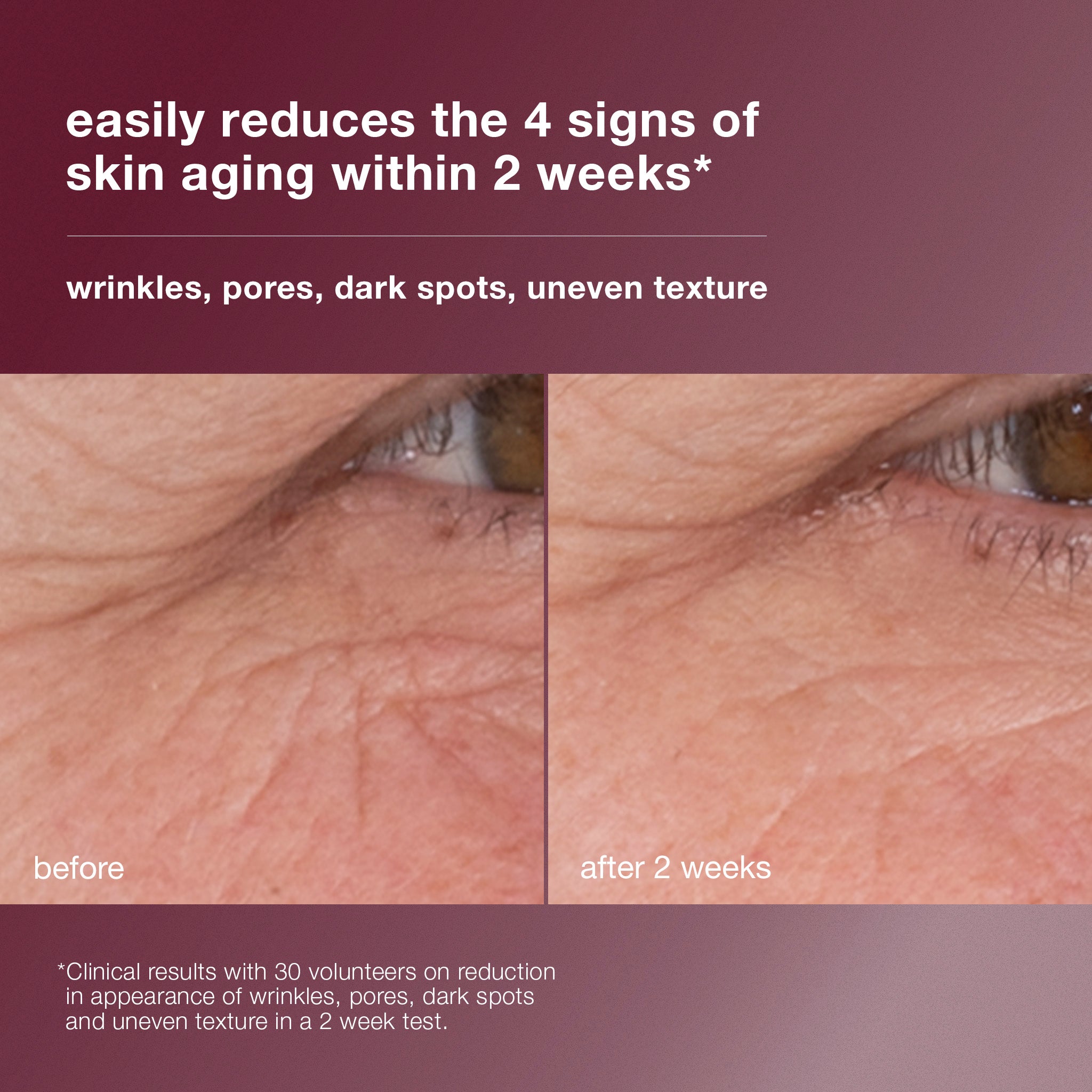 dynamic skin retinol serum