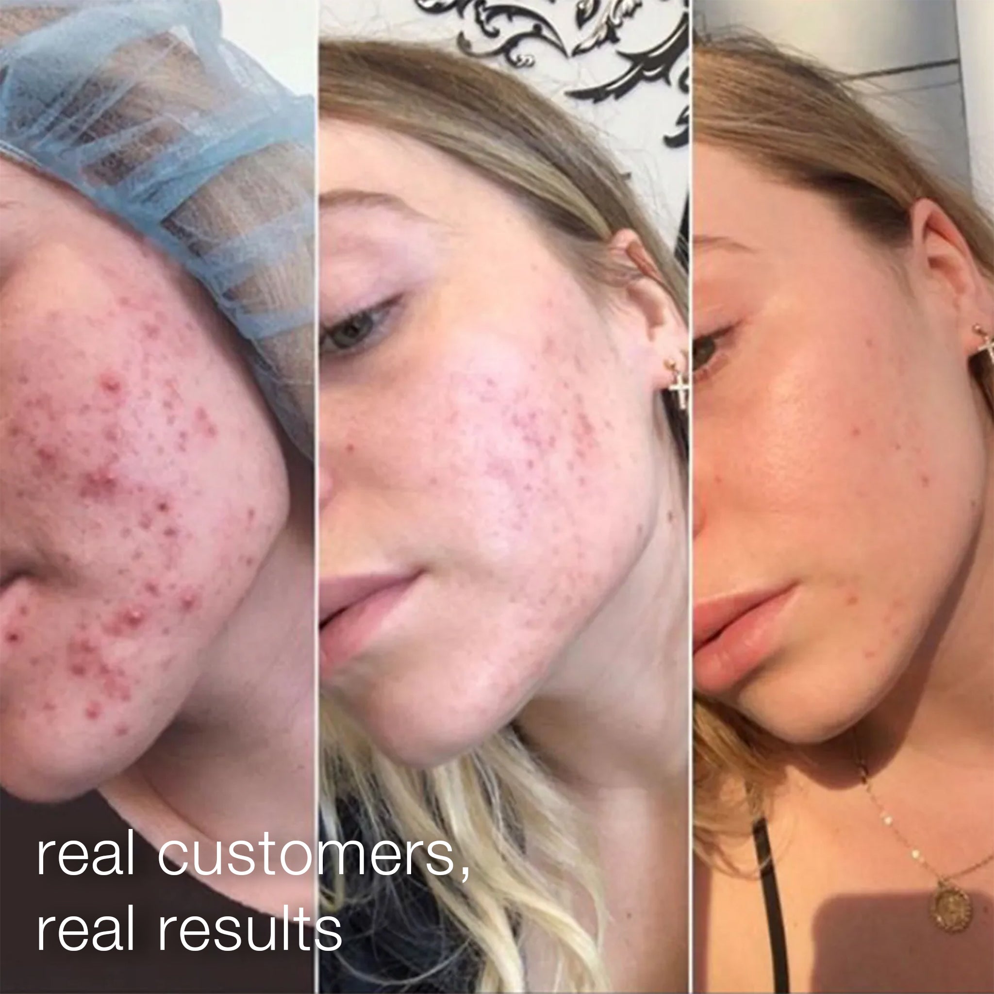 daily microfoliant exfoliator