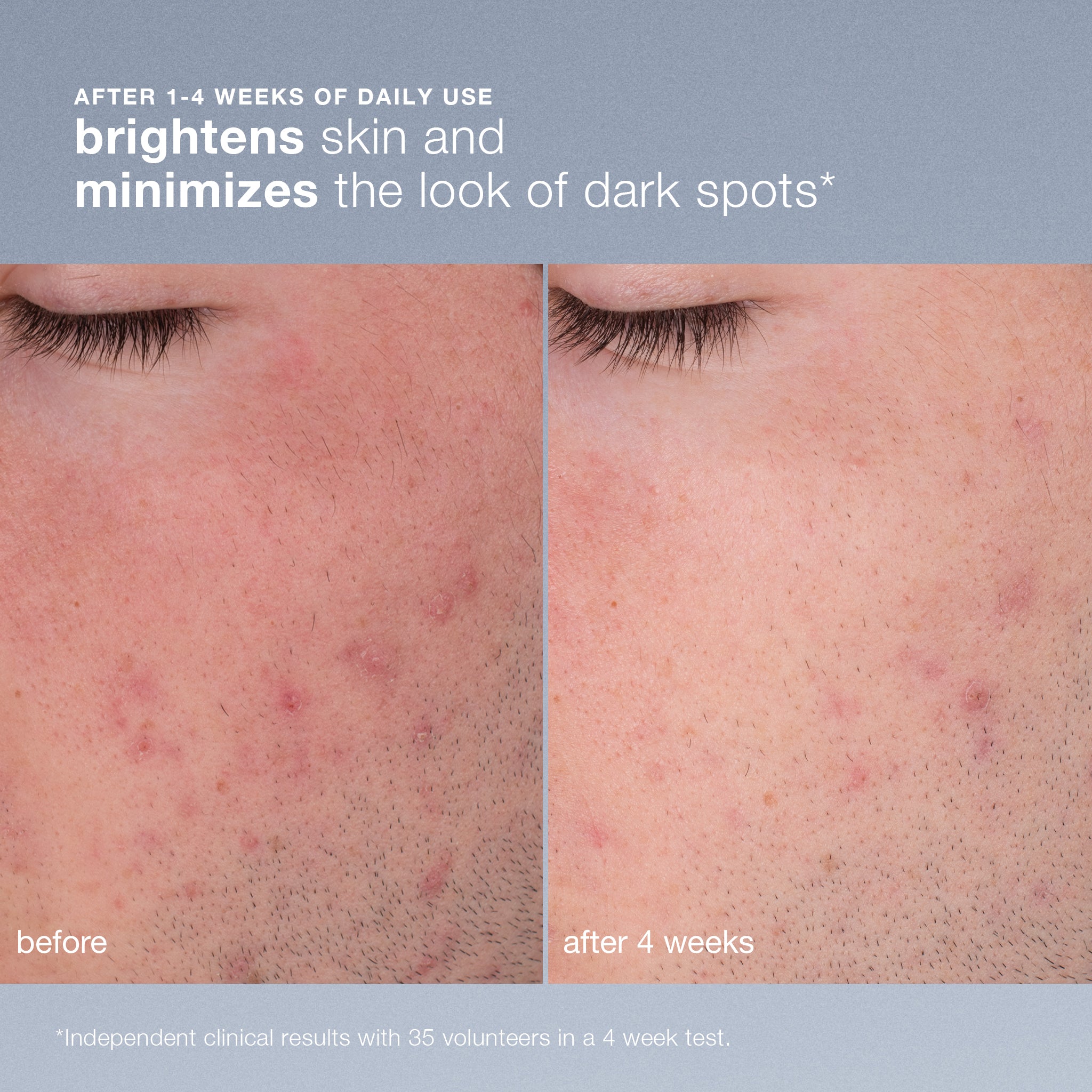 daily microfoliant exfoliator