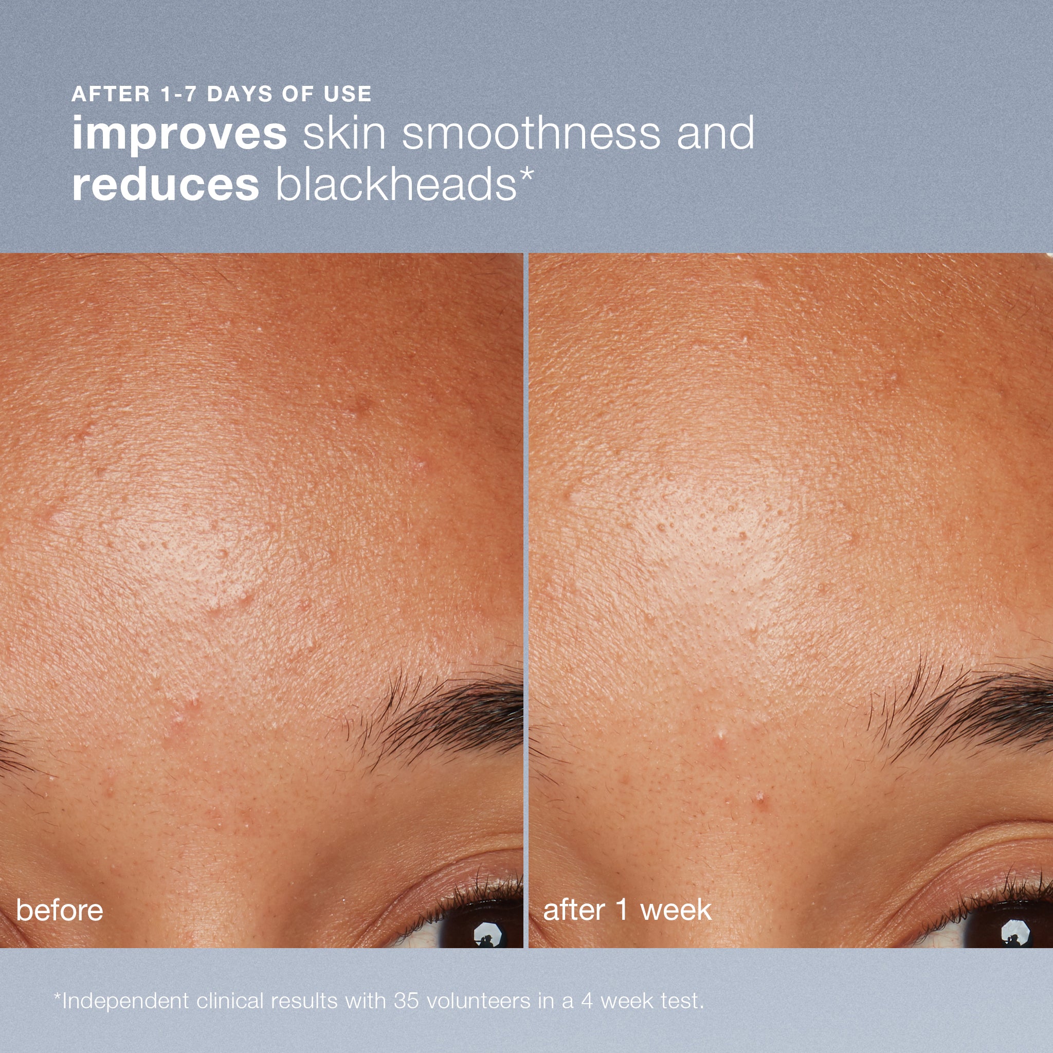 daily microfoliant exfoliator