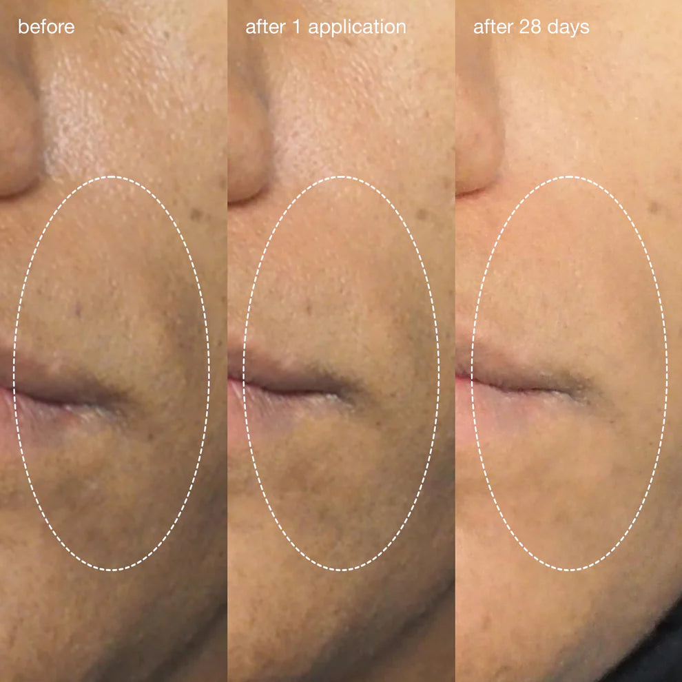 liquid peelfoliant